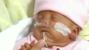 How Young is a Preemie Viable?