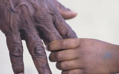 Facing Fear: “Will You Hold My Hand?”