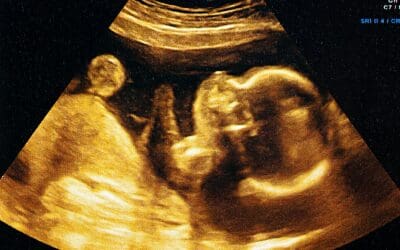 Why I’m Pro-Life